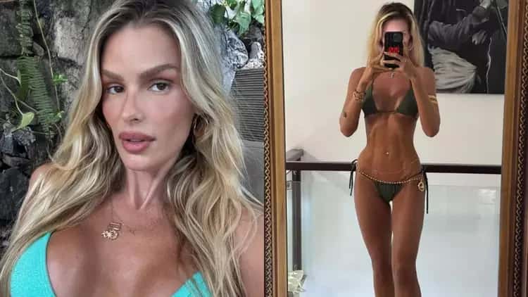 Yasmin Brunet relembra momento inusitado: lipedema foi notado na rua
