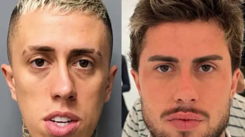 Antes e depois de MC Daniel choca a web: ‘Nem parece a mesma pessoa’